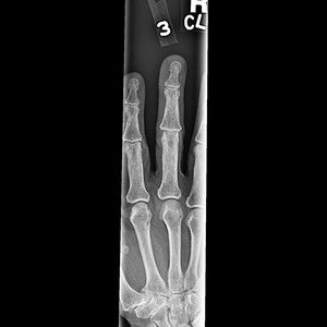 Meet your Posher, Eugene